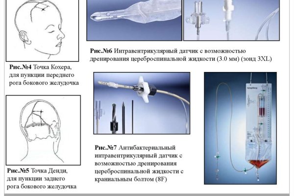 Кракен маркет что это